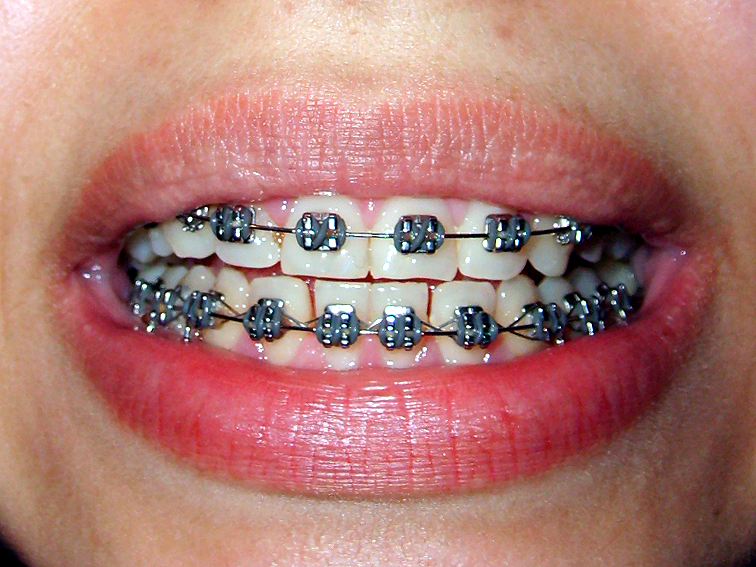 images/ortodonta.jpg28687.jpg